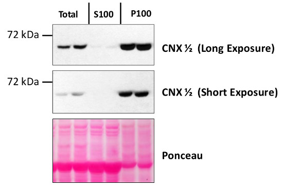 western blot using anti-CNX1/2 antibodies